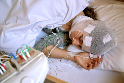 SLEEP STUDY | Accumedicdiagnostics